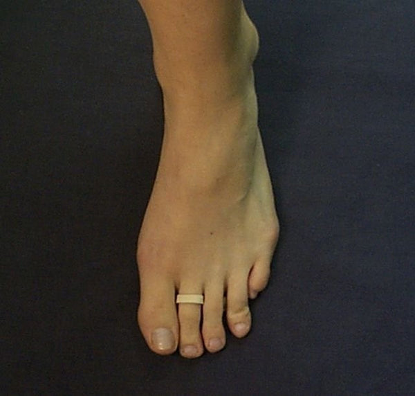 Soft Felt Hammer Toe Cushion