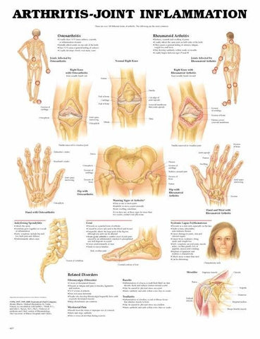 Anatomical Chart Poster