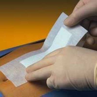 Primapore Post-Op Dressing