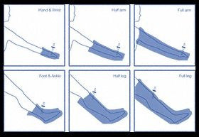 Air Splints - Diamond Athletic