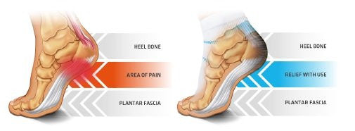 Thermoskin - FXT Compression Socks - for Planter Fasiitis