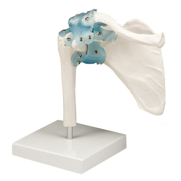 Anatomical Joint Models with Detatachable Ligaments