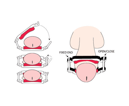 Dribblestop / Penile Clamp