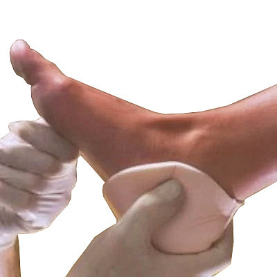 Allevyn Hydrocellular Foam Dressing - Heel