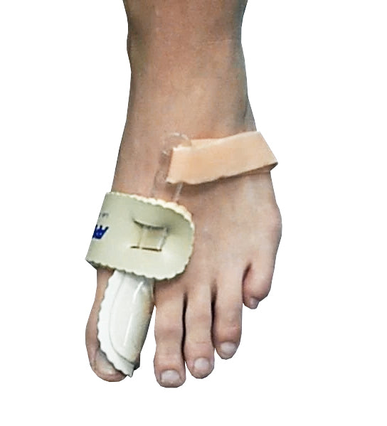 Bunion Regulator