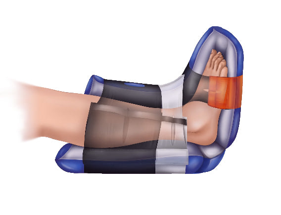 Sage® Prevalon Soft Heel Protector II